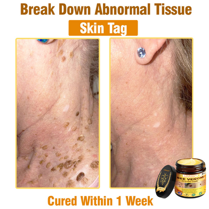 LOVILDS™ Bee Venom Cream – 🌸 Anti-Aging, Hydrating & Skin Repair